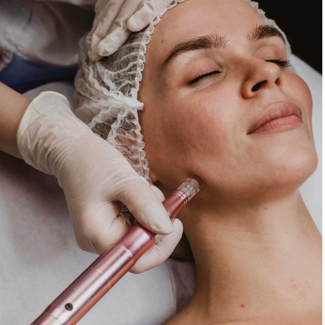 MMP facial
